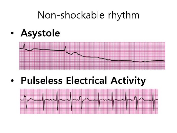 Accesspharmacy antiarrhythmic